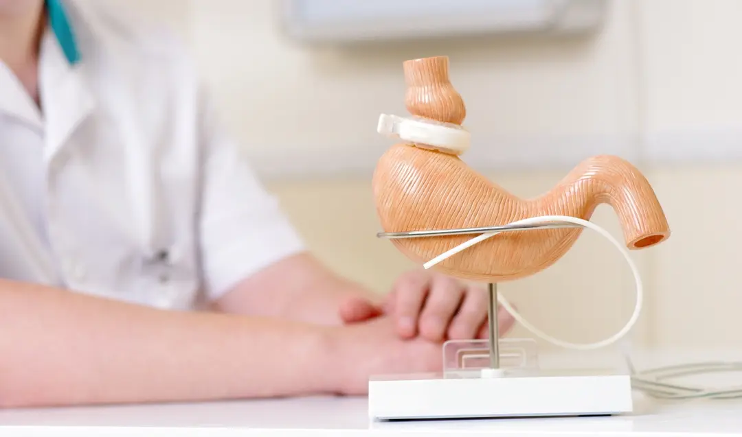 Cirurgia Bariátrica